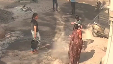 El niño sufrió quemaduras graves. El niño sufrió quemaduras graves.