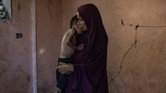 Una señora con un nene que sufre desnutrición. Una señora con un nene que sufre desnutrición.