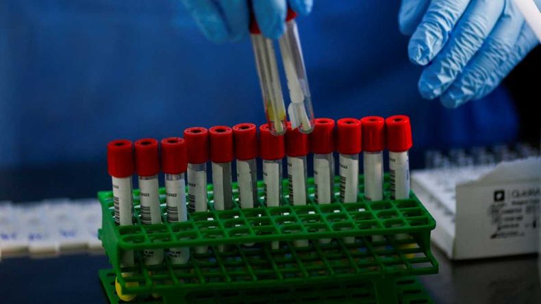 Detectaron a 25 pacientes con la combinación de variantes.
