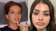 La China Suárez detalló todas las operaciones estéticas que se realizó en su vida. La China Suárez detalló todas las operaciones estéticas que se realizó en su vida.