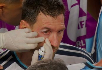 Messi sugrió un golpe y quedó ensangrentado.