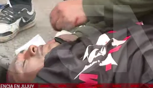 El manifestante fue herido por una lata de gas lacrimógeno.