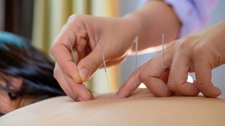 A través de la aucupuntura la paciente creyó que se solucionaría su dolor de rodilla