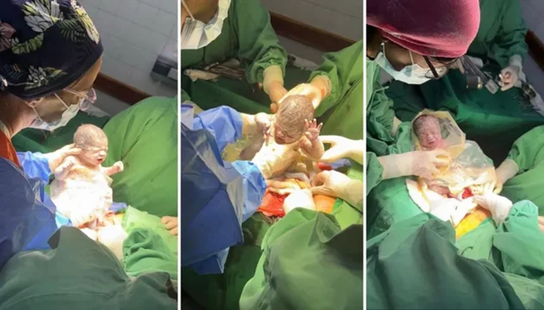 Ainara, Amira y Ámbar nacieron con pesos entre 1.560 a 1.780 gramos.