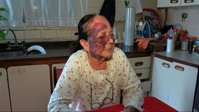 Atacaron violentamente a la mujer mientras dormía.