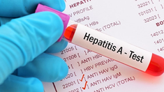 Los casos de hepatitis A subieron en Argentina. Los casos de hepatitis A subieron en Argentina.