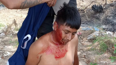 El ataque se produjo el domingo en el barrio 8 de Diciembre, en González Catán (Foto NA). El ataque se produjo el domingo en el barrio 8 de Diciembre, en González Catán (Foto NA).