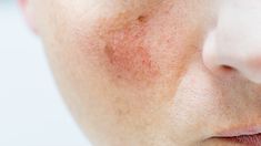 Una de las más recomendadas es una crema nocturna con extractos naturales. Una de las más recomendadas es una crema nocturna con extractos naturales.