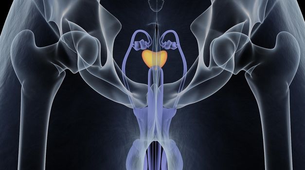 Se conoció una gran noticia sobre el cáncer de próstata.