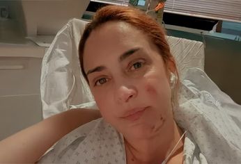 María Julia Oliván sufrió quemaduras en la pierna derecha y la mano