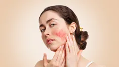 La industria de la belleza desarrolló fórmulas específicas para calmar la dermis y fortalecer su barrera natural. La industria de la belleza desarrolló fórmulas específicas para calmar la dermis y fortalecer su barrera natural.