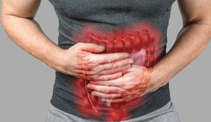 El cáncer de colon es un tipo de cáncer que se forma en los tejidos del colon.