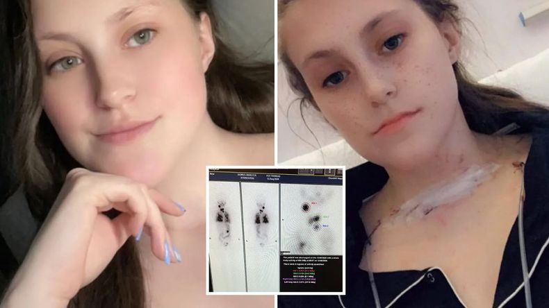La joven había experimentado depresión meses antes, un síntoma que podría estar relacionado con su enfermedad tiroidea, pero no se había investigado a fondo.