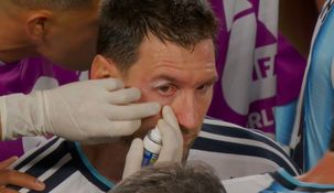Messi sugrió un golpe y quedó ensangrentado.