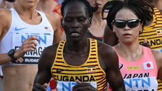 Tenía el 80% de su cuerpo quemado. Tenía el 80% de su cuerpo quemado.