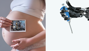 Nacen los primeros bebés fecundados por un robot que crea humanos Nacen los primeros bebés fecundados por un robot que crea humanos