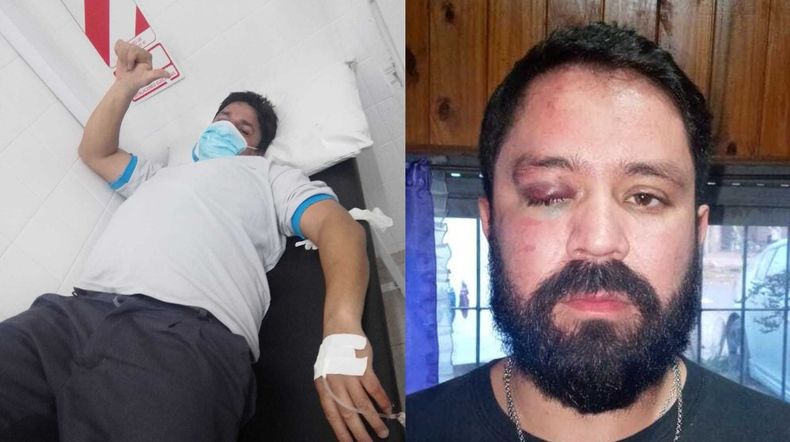 Maquinistas agredidos en Bosques tras accidente fatal