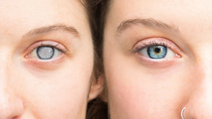 El glaucoma requiere un seguimiento médico.