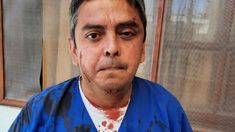 Así quedó el médico Marcelo Cachagua tras la agresión. Así quedó el médico Marcelo Cachagua tras la agresión.