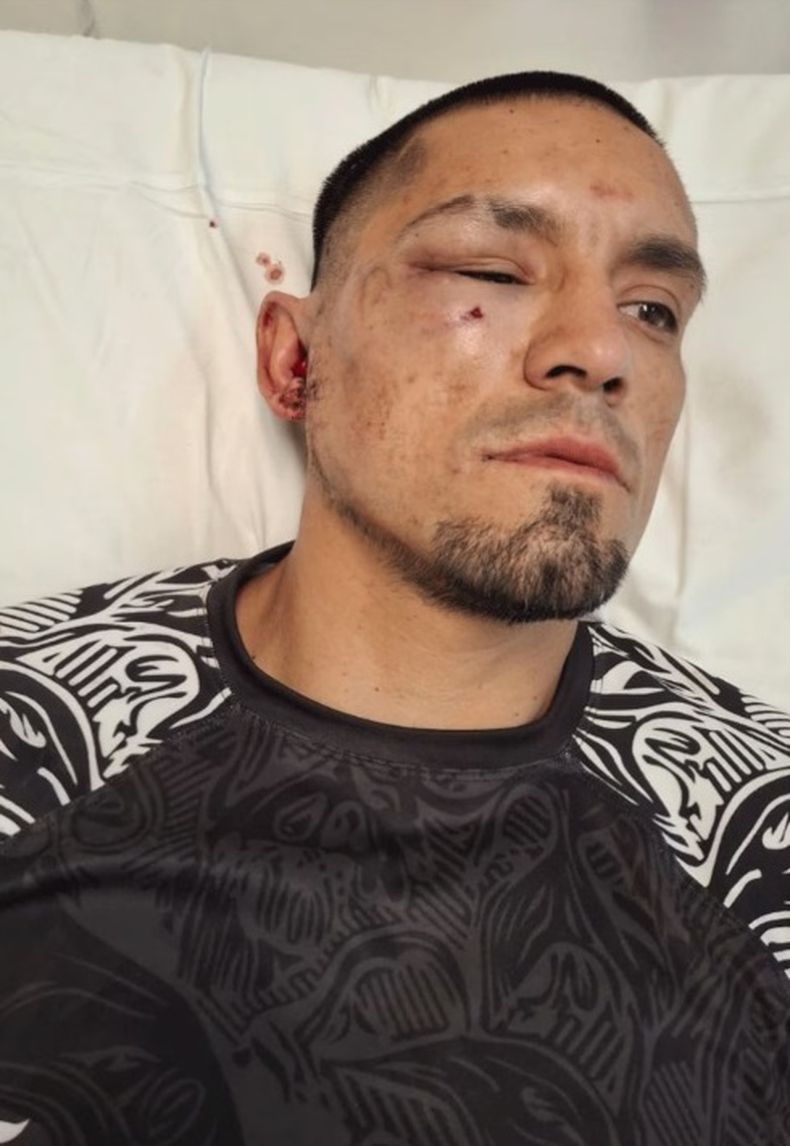 Dramático relato del profesor de kickboxing agredido por la espalda: Tengo la cara quebrada en tres partes