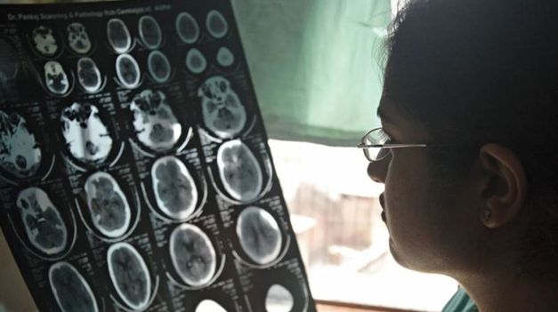 Argentina rechazó una declaración de la ONU para la lucha contra enfermedades no transmisibles y salud mental