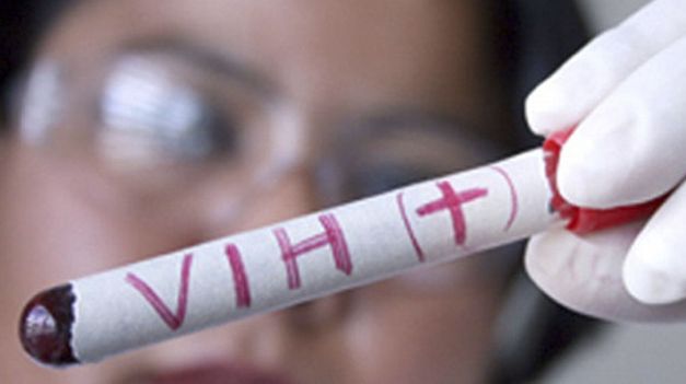 Confirman un tercer caso de curación de VIH luego de un trasplante de células madre.&nbsp;