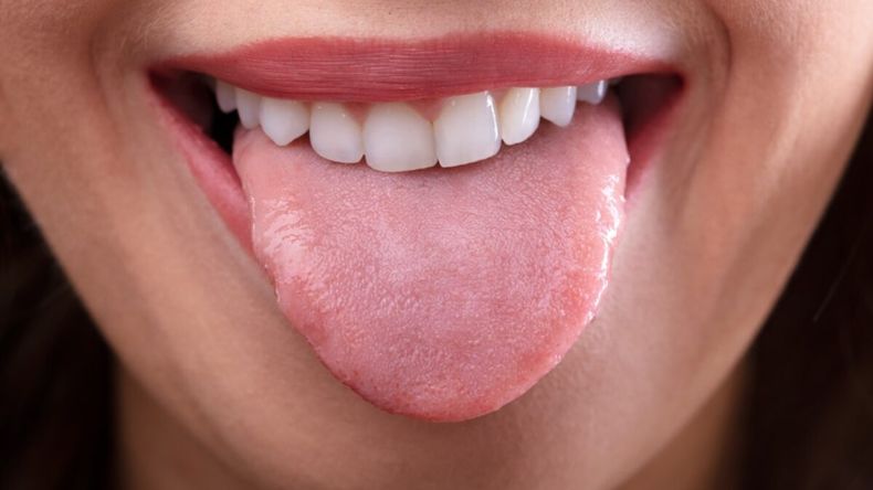 El color de tu lengua puede mostrar si tenes alguna enfermedad