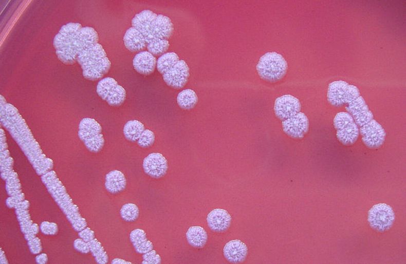 Alarma en EEUU por la detección de la bacteria que produce la memelioidosis humana.