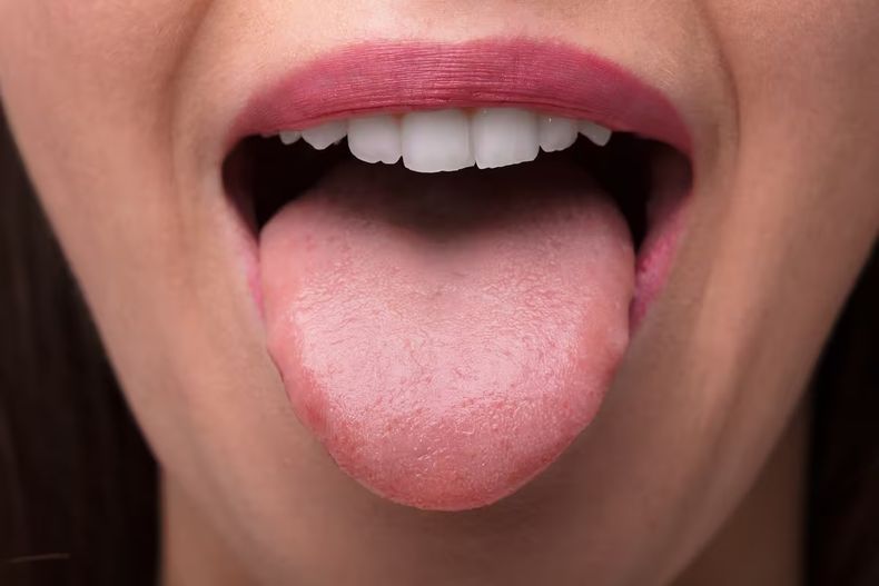 El lavado de lengua es tan importante como el de dientes.