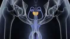 Se conoció una gran noticia sobre el cáncer de próstata. Se conoció una gran noticia sobre el cáncer de próstata.