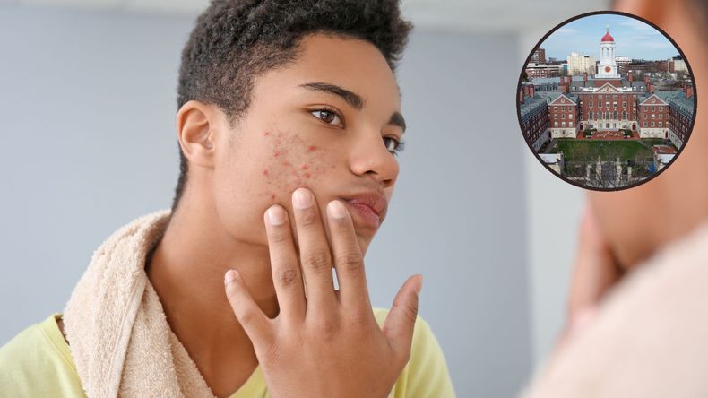 Un estudio de Harvard reveló cuánta cantidad deben usar los adolescentes de productos de cosmetolgía.