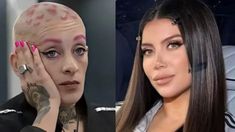 El tratamiento para esta enfermedad puede ser complejo según el tipo de leucemia y según otros factores. El tratamiento para esta enfermedad puede ser complejo según el tipo de leucemia y según otros factores.