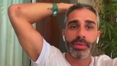 El Pollo Álvarez mostró sus moretones en vivo. El Pollo Álvarez mostró sus moretones en vivo.