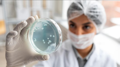La OMS alerta por el virus Maburgo. La OMS alerta por el virus Maburgo.
