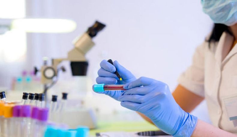 Los investigadores continúan en la búsqueda de una cura de la ELA.