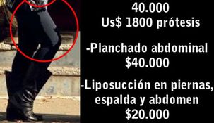 Operación reconquistar a Maradona: Ojeda gastará 110 mil pesos en estética Operación reconquistar a Maradona: Ojeda gastará 110 mil pesos en estética