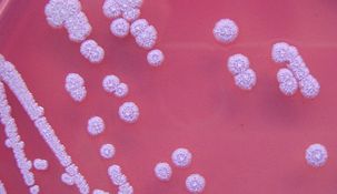 Alarma en EEUU por la detección de la bacteria que produce la memelioidosis humana.