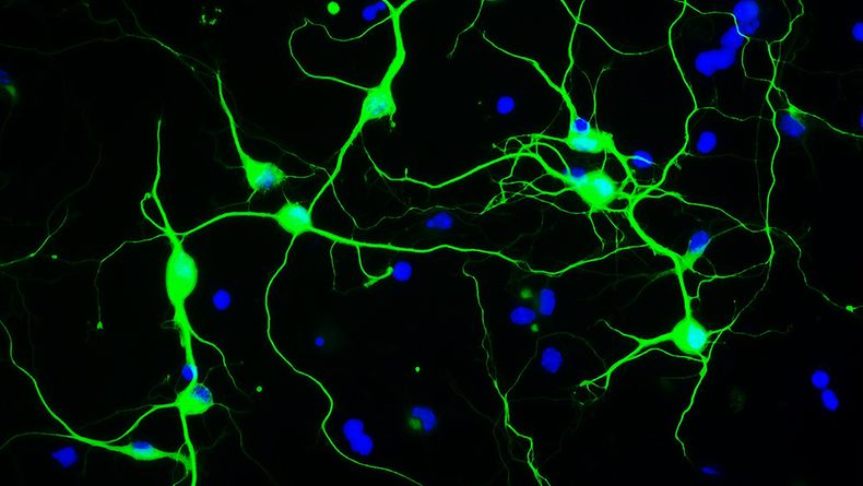 Un nuevo avance sobre la regeneración de neuronas.