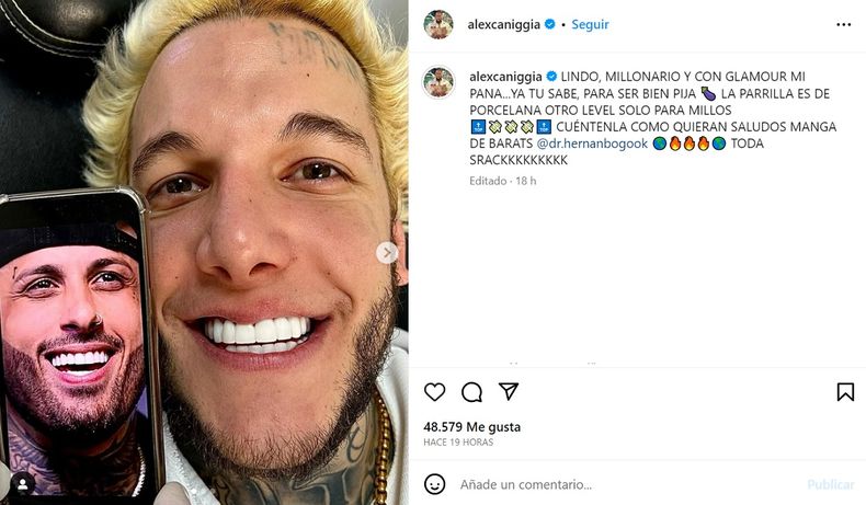 El post de Alex Caniggia sobre su operaci&oacute;n.