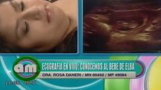 Elba, la ganadora de Masterchef, se hizo una ecografía en vivo Elba, la ganadora de Masterchef, se hizo una ecografía en vivo