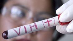 Curan a la primera mujer con VIH a través del trasplante de células madres.