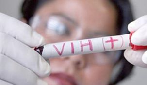 El proyecto de VIH, Hepatitis Virales, Tuberculosis e Infecciones de Transmisión Sexual obtuvo media sanción.