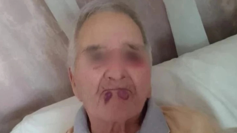 Mar del Plata: clausuraron el geriátrico donde golpearon brutalmente al jubilado