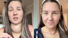 El sorprendente caso de la mujer que tenía un bulto enorme en su cuello