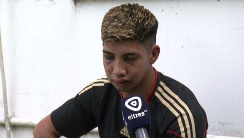 El joven golpeado salvajemente.