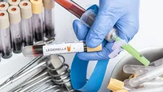 Legionella en Argentina: confirmaron un caso en La Plata.