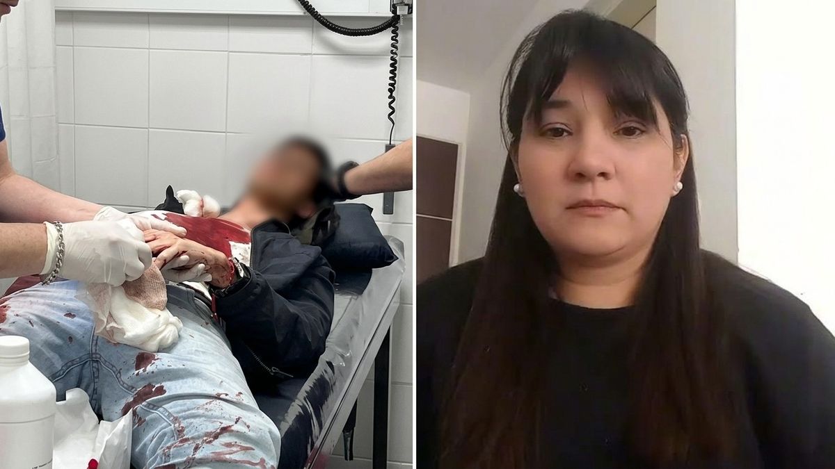 Ataque homofóbico en Tucumán: dos jóvenes fueron víctimas de una brutal golpiza, uno está en terapia intensiva