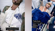 Fede Bal publicó fotos tras el fuerte accidente que sufrió en Brasil Fede Bal publicó fotos tras el fuerte accidente que sufrió en Brasil