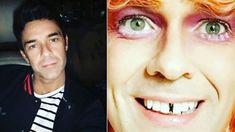 ¿Qué le pasó? La insólita selfie de Mariano Martínez: Tiempo de locura ¿Qué le pasó? La insólita selfie de Mariano Martínez: Tiempo de locura