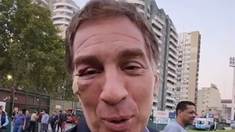Diego Santilli explicó el porqué de los apósitos en su ojo derecho.